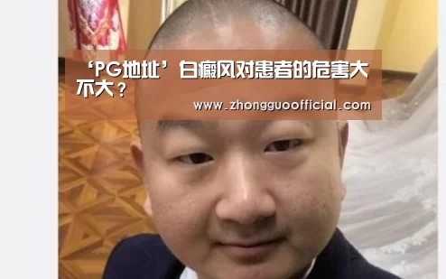 PG中国