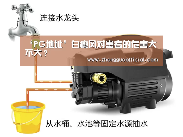 PG中心